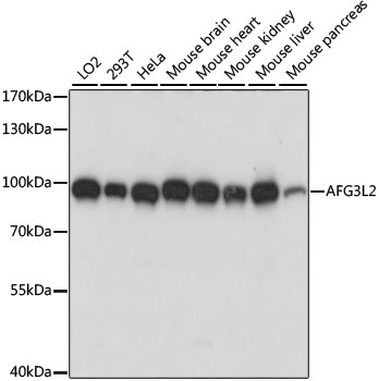 Western blot analysis of extracts of various cell lines using AFG3L2 Polyclonal Antibody at dilution of 1:1000.