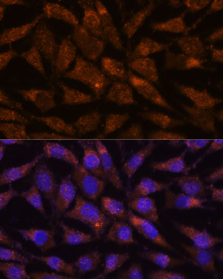 Immunofluorescence analysis of L929 cells using LMAN2 Polyclonal Antibody at dilution of  1:100. Blue: DAPI for nuclear staining.