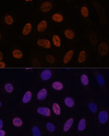 Immunofluorescence analysis of U-2 OS cells using WDHD1 Polyclonal Antibody at dilution of  1:100. Blue: DAPI for nuclear staining.