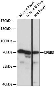 Western blot analysis of extracts of various cell lines using CPEB3 Polyclonal Antibody at dilution of 1:1000.