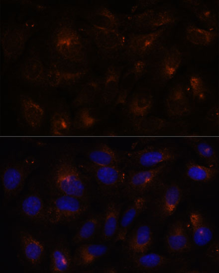 Immunofluorescence analysis of U-2 OS cells using ESYT1 Polyclonal Antibody at dilution of  1:100. Blue: DAPI for nuclear staining.