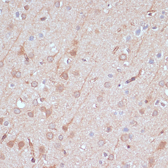 Immunohistochemistry of paraffin-embedded Rat brain using AK5 Polyclonal Antibody at dilution of  1:100 (40x lens).