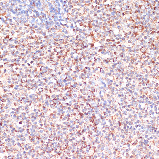 Immunohistochemistry of paraffin-embedded Human lymph node using MRPL46 Polyclonal Antibody at dilution of  1:100 (40x lens).