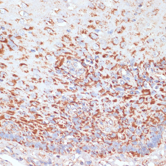 Immunohistochemistry of paraffin-embedded Human esophageal using MRPL46 Polyclonal Antibody at dilution of  1:100 (40x lens).