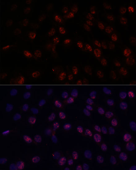 Immunofluorescence analysis of C6 cells using DDX24 Polyclonal Antibody at dilution of  1:100. Blue: DAPI for nuclear staining.