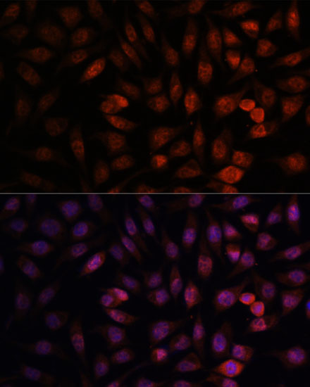 Immunofluorescence analysis of L929 cells using DDX24 Polyclonal Antibody at dilution of  1:100. Blue: DAPI for nuclear staining.