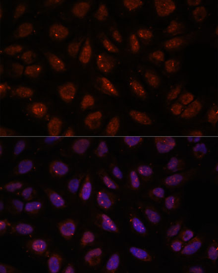 Immunofluorescence analysis of U-2 OS cells using DDX24 Polyclonal Antibody at dilution of  1:100. Blue: DAPI for nuclear staining.