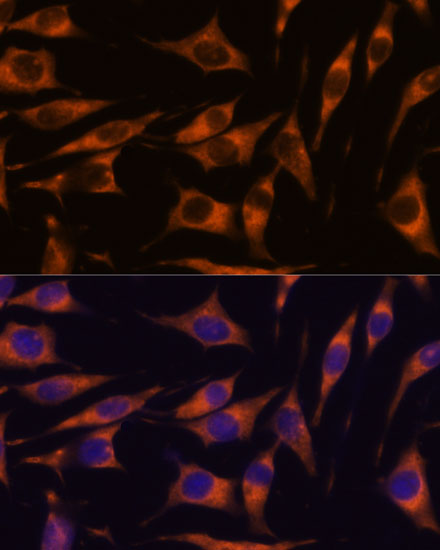 Immunofluorescence analysis of L929 cells using RAPH1 Polyclonal Antibody at dilution of  1:100. Blue: DAPI for nuclear staining.