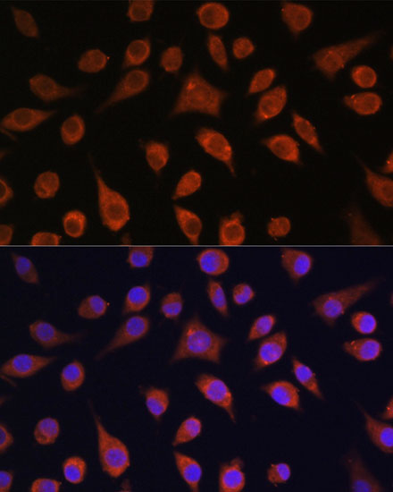 Immunofluorescence analysis of L929 cells using HOOK3 Polyclonal Antibody at dilution of  1:100. Blue: DAPI for nuclear staining.