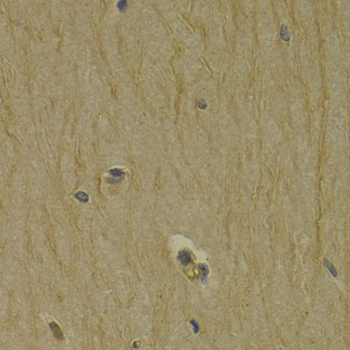 Immunohistochemistry of paraffin-embedded Rat brain using DRD3 Polyclonal Antibody at dilution of  1:200 (40x lens).
