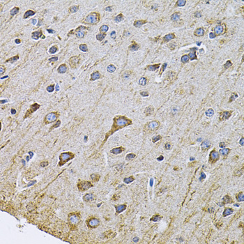 Immunohistochemistry of paraffin-embedded Rat brain using DRD3 Polyclonal Antibody at dilution of  1:100 (40x lens).