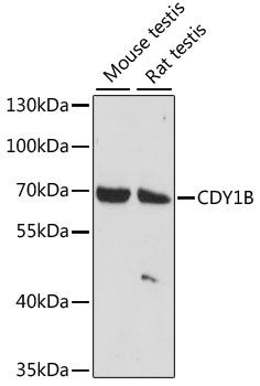 Western blot analysis of extracts of various cell lines using CDY1B Polyclonal Antibody at dilution of 1:1000.