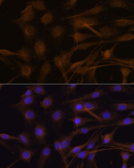 Immunofluorescence analysis of C6 cells using TIMP2 Polyclonal Antibody at dilution of  1:100. Blue: DAPI for nuclear staining.