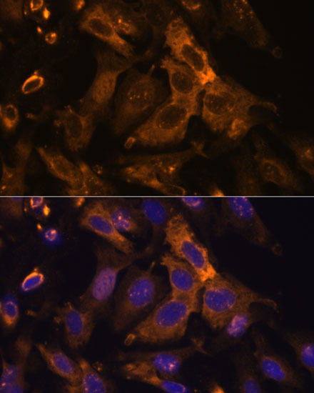 Immunofluorescence analysis of U-2 OS cells using TIMP2 Polyclonal Antibody at dilution of  1:100. Blue: DAPI for nuclear staining.