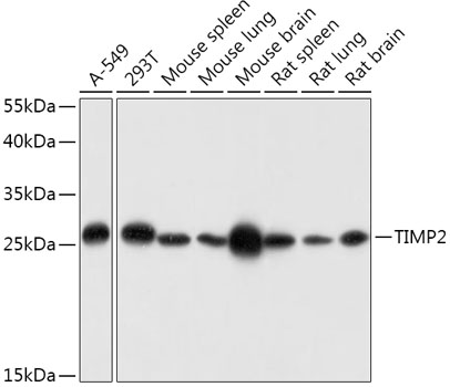 Western blot analysis of extracts of various cell lines using TIMP2 Polyclonal Antibody at dilution of 1:1000.