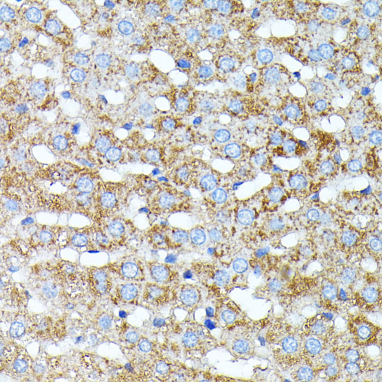 Immunohistochemistry of paraffin-embedded Rat liver using HP Polyclonal Antibody at dilution of  1:100 (40x lens).