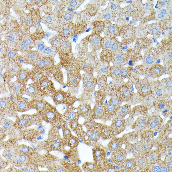 Immunohistochemistry of paraffin-embedded Mouse liver using HP Polyclonal Antibody at dilution of  1:100 (40x lens).