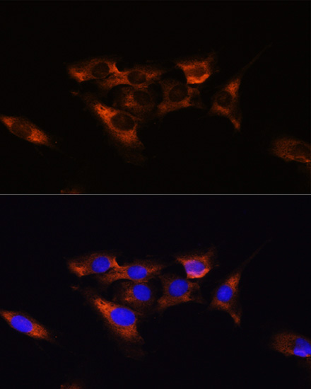 Immunofluorescence analysis of C6 cells using ADORA2A Polyclonal Antibody at dilution of  1:100. Blue: DAPI for nuclear staining.