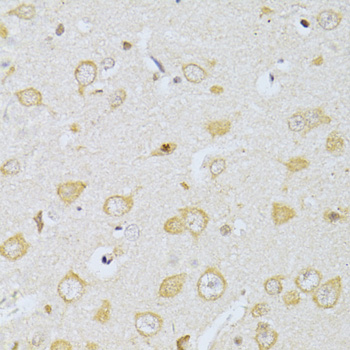 Immunohistochemistry of paraffin-embedded Rat brain using CHRNA7 Polyclonal Antibody at dilution of  1:100 (40x lens).