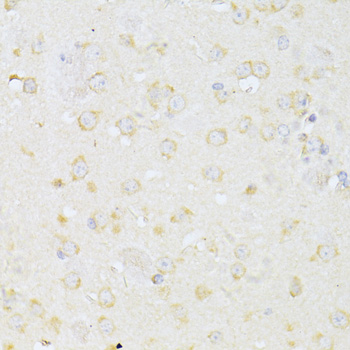 Immunohistochemistry of paraffin-embedded Mouse brain using CHRNA7 Polyclonal Antibody at dilution of  1:100 (40x lens).