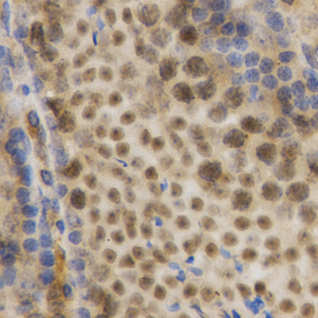 Immunohistochemistry of paraffin-embedded Mouse testis using HuR / ELAVL1 Polyclonal Antibody at dilution of  1:200 (40x lens).