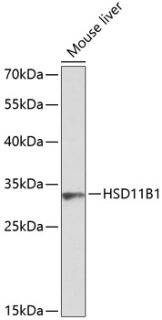 Western blot analysis of extracts of Mouse liver using HSD11B1 Polyclonal Antibody at dilution of 1:1000.