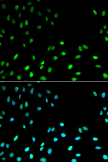 Immunofluorescence analysis of MCF-7 cells using RFC1 Polyclonal Antibody