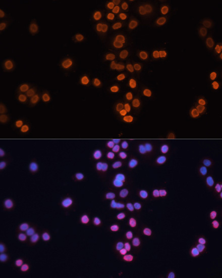 Immunofluorescence analysis of HT-29 cells using CDX2 Polyclonal Antibody at dilution of  1:100. Blue: DAPI for nuclear staining.