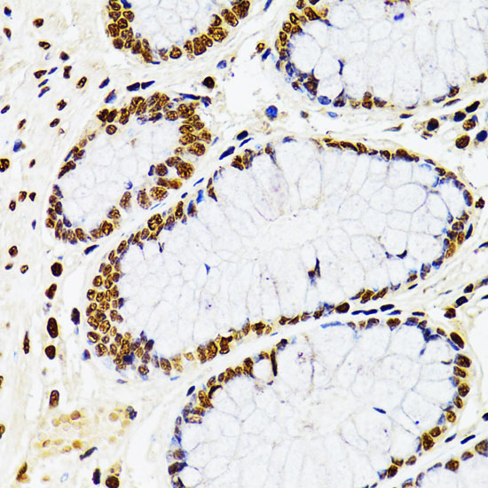 Immunohistochemistry of paraffin-embedded Human rectum using CDX2 Polyclonal Antibody at dilution of  1:100 (40x lens).