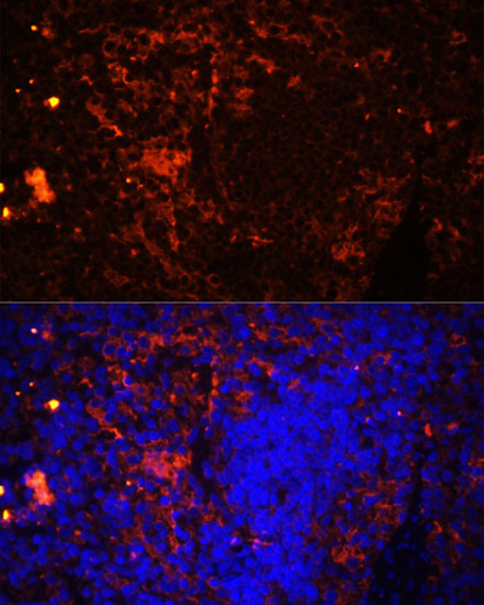 Immunofluorescence analysis of Rat spleen using CD11A Polyclonal Antibody at dilution of  1:100 (40x lens). Blue: DAPI for nuclear staining.