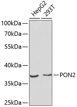 Western blot analysis of extracts of various cell lines using PON2 Polyclonal Antibody at dilution of 1:1000.