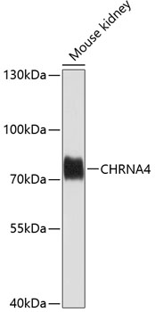 Western blot analysis of extracts of Mouse kidney using CHRNA4 Polyclonal Antibody at dilution of 1:1000.