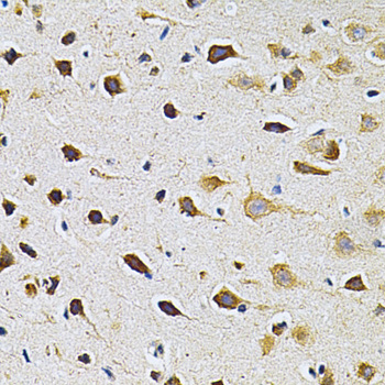 Immunohistochemistry of paraffin-embedded Rat brain using ADRBK1 Polyclonal Antibody at dilution of  1:200 (40x lens).