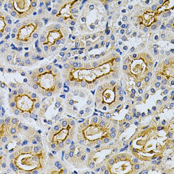 Immunohistochemistry of paraffin-embedded Mouse kidney using ADRBK1 Polyclonal Antibody at dilution of  1:200 (40x lens).