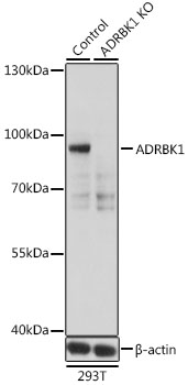 Western blot analysis of extracts from normal (control) and ADRBK1 knockout (KO) 293T cells using ADRBK1 Polyclonal Antibody at dilution of 1:500.