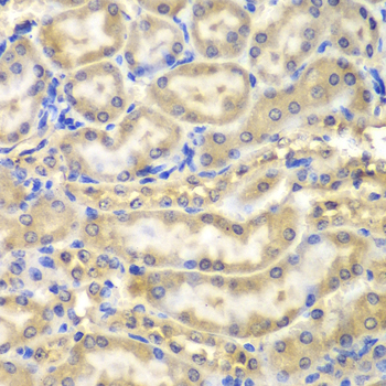 Immunohistochemistry of paraffin-embedded Mouse kidney using Myelin Basic protein Polyclonal Antibody at dilution of  1:200 (40x lens).