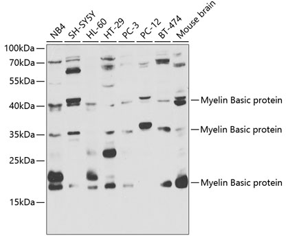 Western blot analysis of extracts of various cell lines using Myelin Basic protein Polyclonal Antibody at dilution of 1:1000.