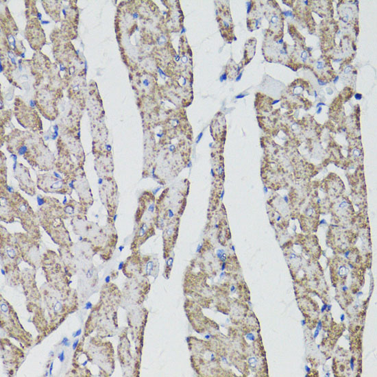 Immunohistochemistry of paraffin-embedded Rat heart using CD59 Polyclonal Antibody at dilution of  1:100 (40x lens).