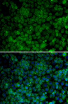 Immunofluorescence analysis of HeLa cells using CDK7 Polyclonal Antibody