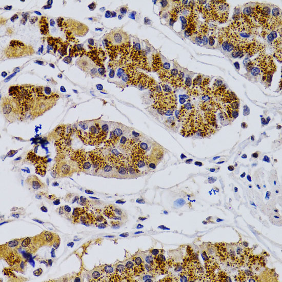 Immunohistochemistry of paraffin-embedded Human stomach using CDK7 Polyclonal Antibody at dilution of  1:200 (40x lens).