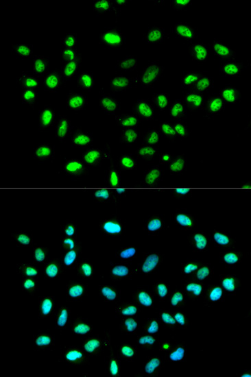 Immunofluorescence analysis of MCF-7 cells using HNRNPK Polyclonal Antibody