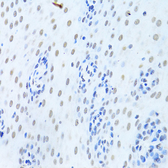 Immunohistochemistry of paraffin-embedded Human esophagus using HNRNPK Polyclonal Antibody at dilution of  1:200 (40x lens).