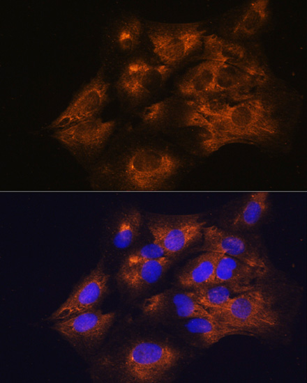 Immunofluorescence analysis of C6 cells using C1 Inactivator Polyclonal Antibody at dilution of  1:100. Blue: DAPI for nuclear staining.