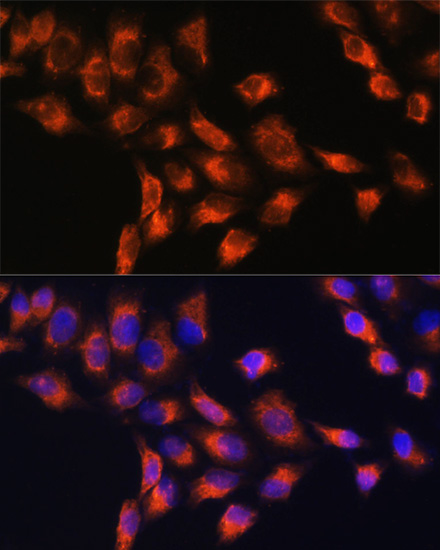 Immunofluorescence analysis of HeLa cells using C1 Inactivator Polyclonal Antibody at dilution of  1:100. Blue: DAPI for nuclear staining.