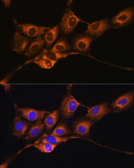 Immunofluorescence analysis of NIH/3T3 cells using C1 Inactivator Polyclonal Antibody at dilution of  1:100. Blue: DAPI for nuclear staining.