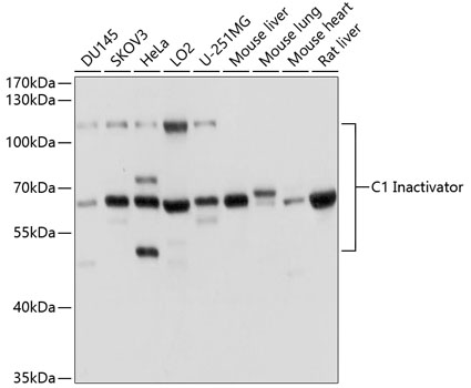 Western blot analysis of extracts of various cell lines using C1 Inactivator Polyclonal Antibody at dilution of 1:1000.