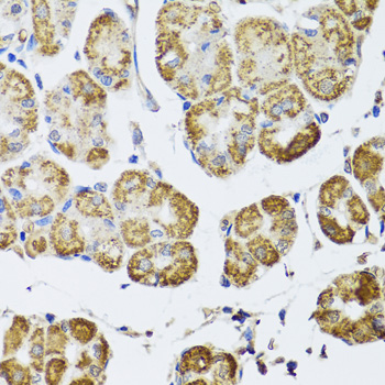 Immunohistochemistry of paraffin-embedded Human stomach using HDAC6 Polyclonal Antibody at dilution of  1:100 (40x lens).
