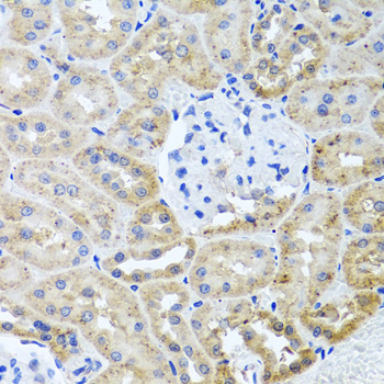 Immunohistochemistry of paraffin-embedded Rat kidney using HDAC6 Polyclonal Antibody at dilution of  1:100 (40x lens).