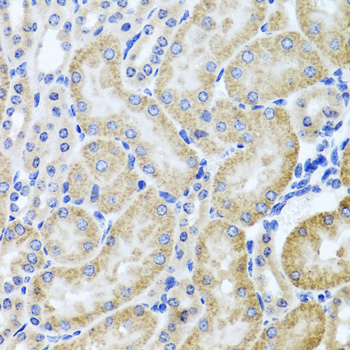 Immunohistochemistry of paraffin-embedded Mouse kidney using HDAC6 Polyclonal Antibody at dilution of  1:100 (40x lens).
