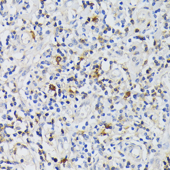 Immunohistochemistry of paraffin-embedded Human tonsil using CD3E Polyclonal Antibody at dilution of  1:200 (40x lens).